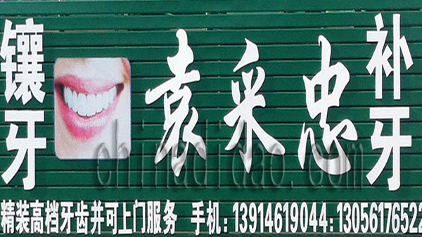 镶牙 补牙 袁采忠